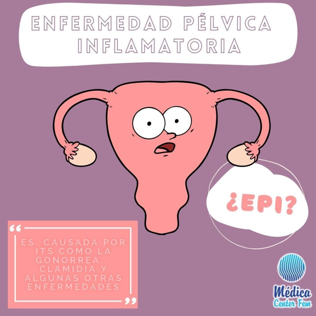 Enfermedad Pélvica Inflamatoria-