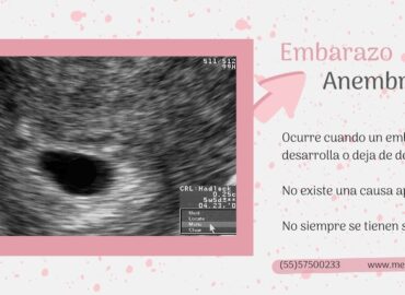 embarazo-anembrionico