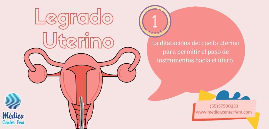 ¿Qué es el Legrado Uterino y en qué consiste? - Clínicas de Aborto en